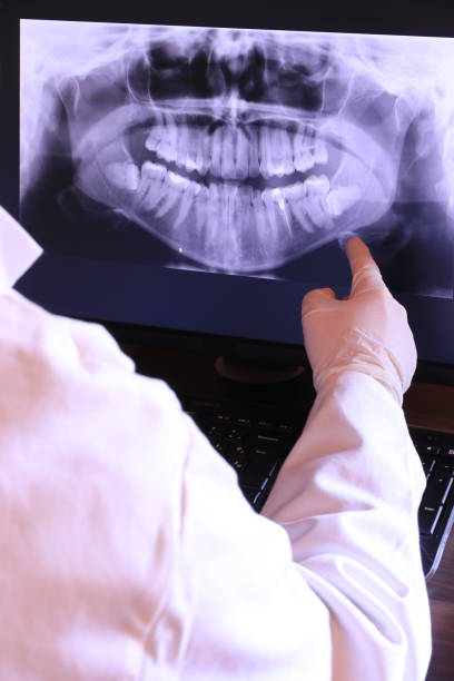 Best Emergency Treatment for Dental Infections or Abscesses in Durant, MS